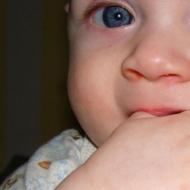 Mata bayi berair: punca kebimbangan atau fenomena yang tidak berbahaya