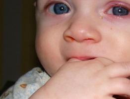 Oči dítěte slzí: důvod k obavám nebo neškodný jev
